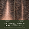Load image into Gallery viewer, Anti Hair Loss Shampoo
