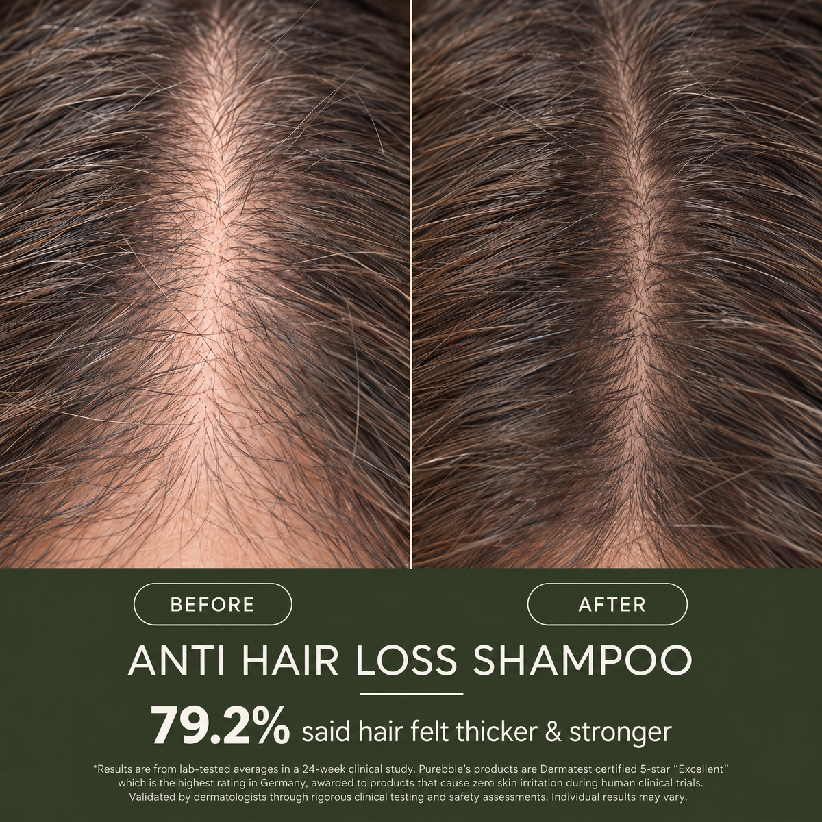 Anti Hair Loss Shampoo