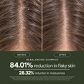 Load image into Gallery viewer, Rebalancing Shampoo

