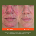 Load image into Gallery viewer, Daily Skin Purifying Mist
